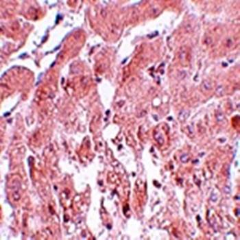 SUMO2/3 Antibody