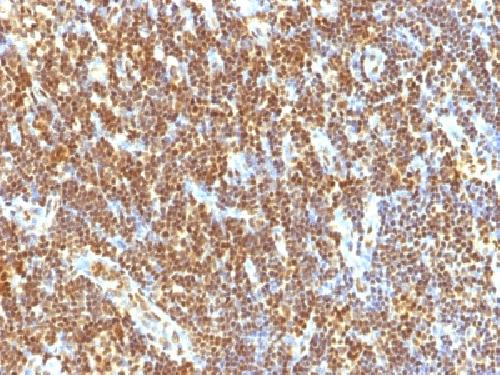 SUMO2 antibody