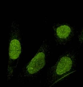 SUN1 Antibody