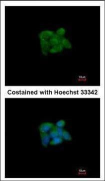 SUOX antibody