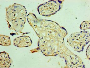 Suppressor of cytokine signaling 1 antibody