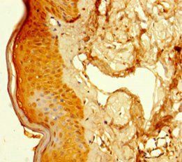 SUPT16H Antibody