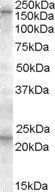 Goat anti-SUR1 / ABCC8 Antibody