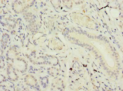 SUSD4 Antibody