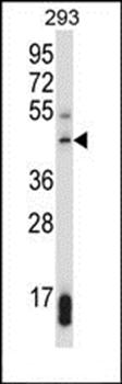 SUV39H1 antibody