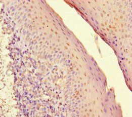 SUV39H1 Antibody