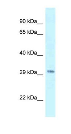 Suv420h1 antibody