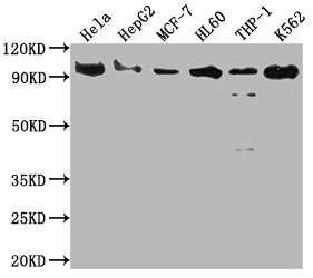 SUZ12 Recombinant Monoclonal Antibody