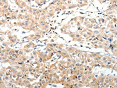 SV2A Antibody