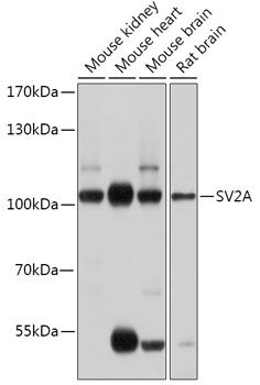 SV2A antibody