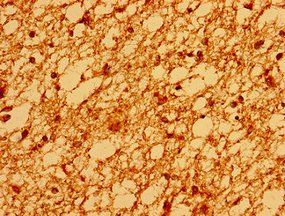 SV2A Antibody