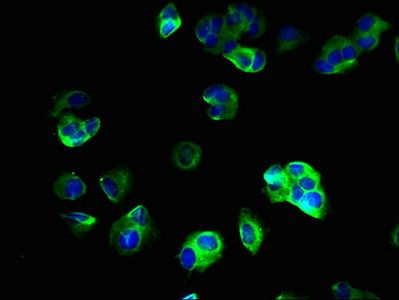 SV2B antibody