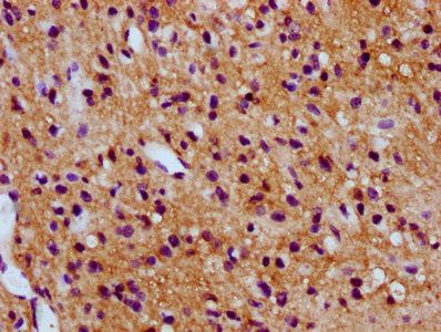 SV2C Antibody