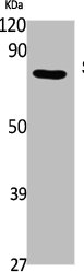 SV2C antibody