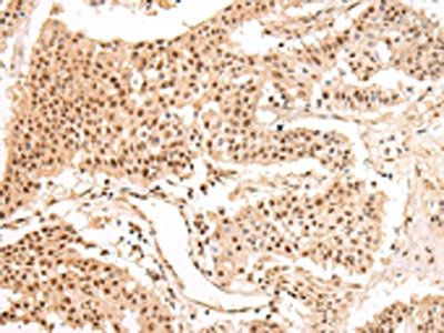 SWAP70 Antibody