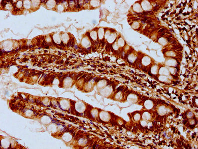 SYCE3 antibody