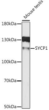SYCP1 antibody