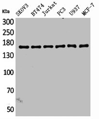 SYCP2 Antibody