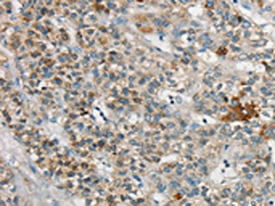 SYCP3 Antibody