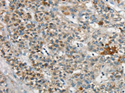 SYCP3 antibody