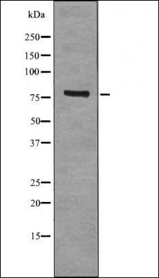 SYK (Phospho-Tyr525+Tyr526) antibody