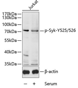 Syk (Phospho-Y525/526) antibody