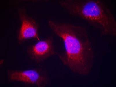 syk (phospho-Tyr323) Antibody