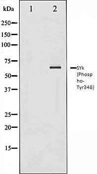 SYk (Phospho-Tyr348) antibody