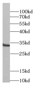 Synaptogyrin-4 antibody