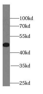 Synaptotagmin-12 antibody