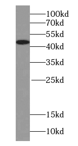 Synaptotagmin-13 antibody