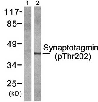 Synaptotagmin (phospho-Thr202) antibody
