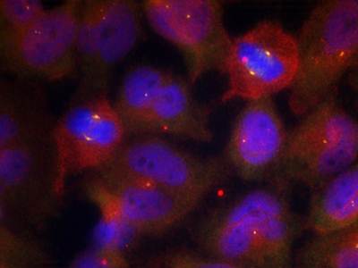 Synaptotagmin 1/2 (Phospho-Thr202/199) Antibody