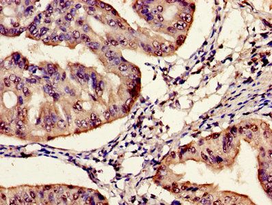 SYNE2 Antibody