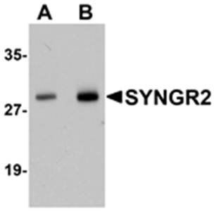 SYNGR2 Antibody