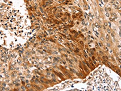 SYNPO2 Antibody