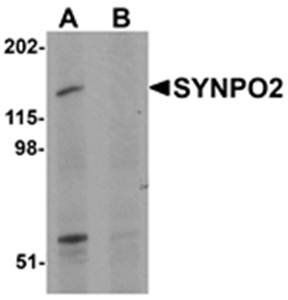 SYNPO2 Antibody