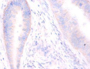 STX6 Antibody