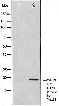alpha synuclein (Phospho-Tyr133) antibody