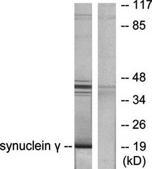 Synuclein gamma antibody
