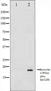 alpha synuclein (Phospho-Ser129) antibody