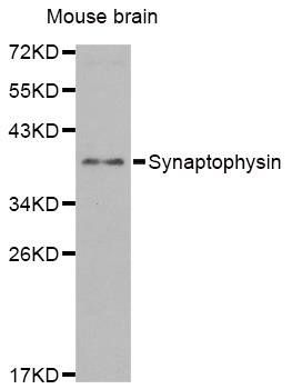 SYP antibody