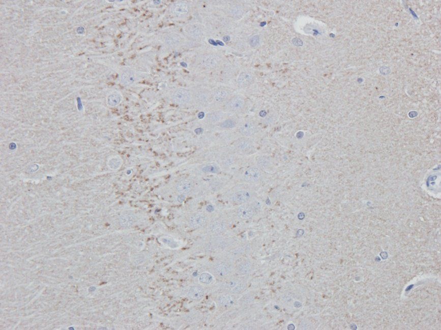 SYP antibody