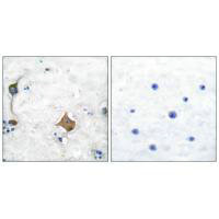 SYP Antibody