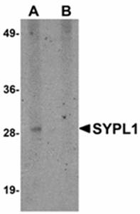 SYPL1 Antibody