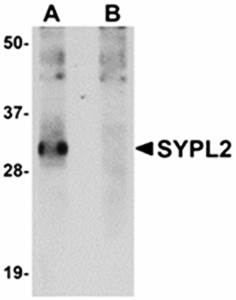 SYPL2 Antibody