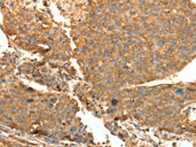 SYT11 Antibody