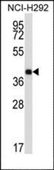 SYT2 antibody
