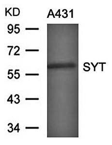 SYT Antibody