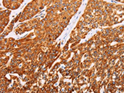 SYVN1 Antibody